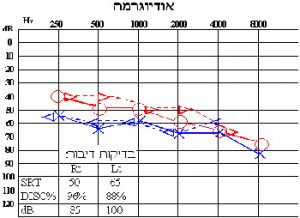 בדיקות שמיעה במכון שמיעה תדרים