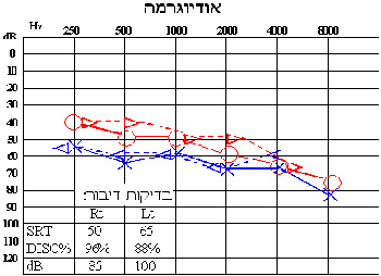 בדיקות שמיעה במכון שמיעה תדרים